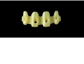 Cod.E22 f Upper Anterior: 10x  hollow pontics blocks-frames, (12-22), carved to fit into wax veneers Cod.E22Upper Anterior, MEDIUM,not arched, (12-22), for porcelain pressed to metal bridgework